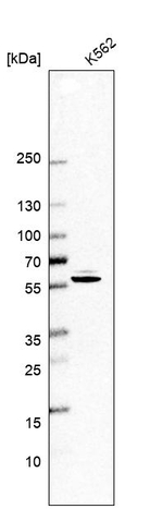DLD Antibody in Western Blot (WB)