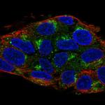 UBIAD1 Polyclonal Antibody