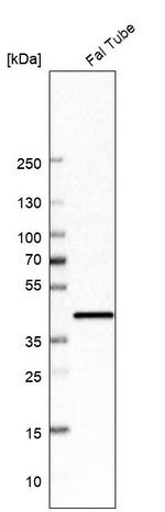 UBIAD1 Antibody in Western Blot (WB)