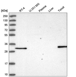 NSMCE4A Antibody in Western Blot (WB)