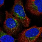 COPD Polyclonal Antibody
