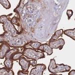 FVT1 Polyclonal Antibody