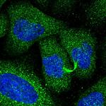 PIK3CD Polyclonal Antibody