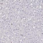 PIK3CD Antibody in Immunohistochemistry (Paraffin) (IHC (P))
