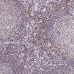 PIK3CD Antibody in Immunohistochemistry (Paraffin) (IHC (P))