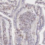 PIK3CD Antibody in Immunohistochemistry (Paraffin) (IHC (P))