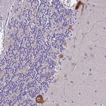 NAP1L6 Polyclonal Antibody