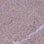 UBC13 Antibody in Immunohistochemistry (Paraffin) (IHC (P))