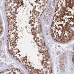 UBC13 Antibody in Immunohistochemistry (Paraffin) (IHC (P))