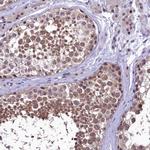 PRNT Antibody in Immunohistochemistry (Paraffin) (IHC (P))