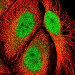 RSK3 Antibody in Immunocytochemistry (ICC/IF)