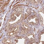 RSK3 Antibody in Immunohistochemistry (Paraffin) (IHC (P))