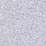 Cytokeratin 17 Antibody in Immunohistochemistry (Paraffin) (IHC (P))