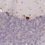 RPL8 Antibody in Immunohistochemistry (Paraffin) (IHC (P))