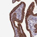 RPL8 Antibody in Immunohistochemistry (Paraffin) (IHC (P))