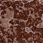 RPL8 Antibody in Immunohistochemistry (Paraffin) (IHC (P))