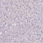 TMEM236 Polyclonal Antibody