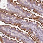 TMEM236 Antibody in Immunohistochemistry (Paraffin) (IHC (P))