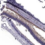 PDE6H Antibody in Immunohistochemistry (Paraffin) (IHC (P))