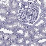 PDE6H Antibody in Immunohistochemistry (Paraffin) (IHC (P))