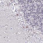 BAF53B Antibody in Immunohistochemistry (Paraffin) (IHC (P))