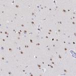 BAF53B Antibody in Immunohistochemistry (Paraffin) (IHC (P))