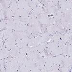 BAF53B Antibody in Immunohistochemistry (Paraffin) (IHC (P))