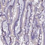 MUC13 Antibody in Immunohistochemistry (Paraffin) (IHC (P))