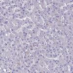 MUC13 Polyclonal Antibody