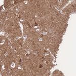 FKBP8 Antibody in Immunohistochemistry (Paraffin) (IHC (P))