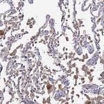 SGMS1 Antibody in Immunohistochemistry (Paraffin) (IHC (P))