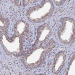 SGMS1 Antibody in Immunohistochemistry (Paraffin) (IHC (P))