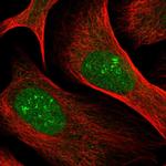 MRLC2 Polyclonal Antibody