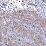 MRLC2 Antibody in Immunohistochemistry (Paraffin) (IHC (P))