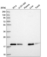 MRLC2 Antibody in Western Blot (WB)