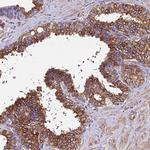 STC2 Antibody in Immunohistochemistry (Paraffin) (IHC (P))
