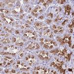 ATP4B Antibody in Immunohistochemistry (Paraffin) (IHC (P))