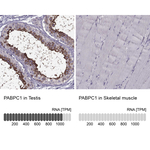 PABPC1 Polyclonal Antibody