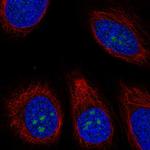 TMEM217 Polyclonal Antibody