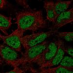 ZNF560 Polyclonal Antibody