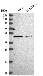 HARBI1 Antibody in Western Blot (WB)