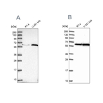 KPNA4 Antibody in Western Blot (WB)