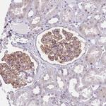 PODXL Antibody in Immunohistochemistry (Paraffin) (IHC (P))