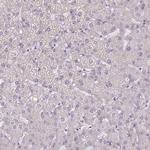 PODXL Polyclonal Antibody