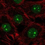 NSUN5 Polyclonal Antibody