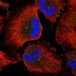 CEP170 Polyclonal Antibody