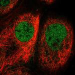 Cofilin 2 Polyclonal Antibody