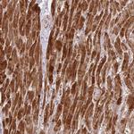 Cofilin 2 Antibody in Immunohistochemistry (Paraffin) (IHC (P))