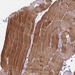 Cofilin 2 Antibody in Immunohistochemistry (Paraffin) (IHC (P))