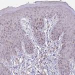 Cofilin 2 Antibody in Immunohistochemistry (Paraffin) (IHC (P))